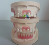 TCS Unbreakable Valplast_ Flexible Partial denture base from